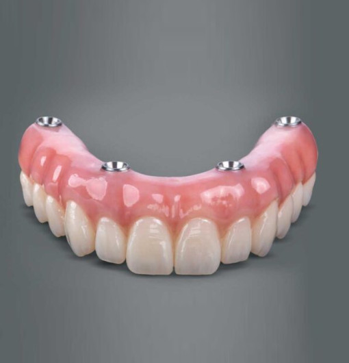 Full Mouth Rehabilitation (FMR) & Dentures